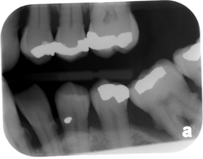 tooth anomalies – Page 4 – Dr. G's Toothpix
