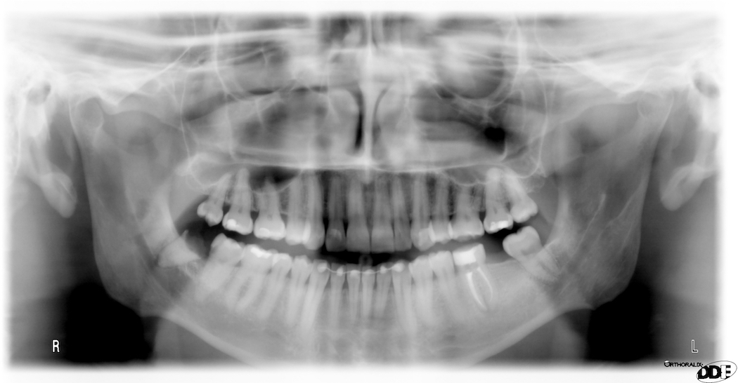 Anatomy – soft tissue of ear – drgstoothpix 3 – Dr. G's Toothpix