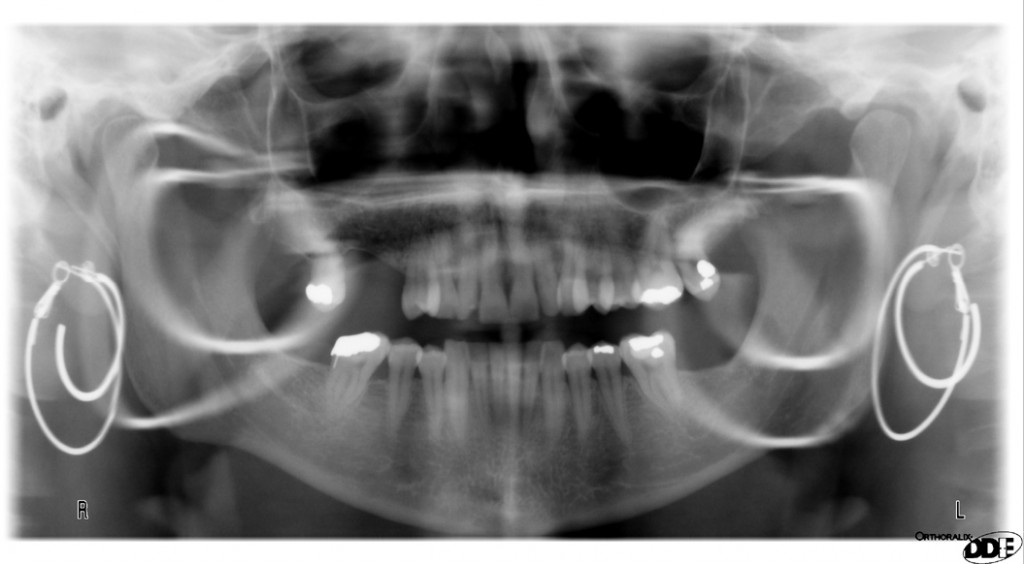 Radiographic Technique: Patient preparation – Dr. G's Toothpix