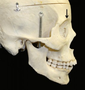 supraorbitale dry skull lateral view