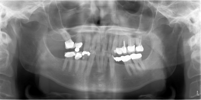 Dr. G's Toothpix | An oral radiology source for dental professionals ...