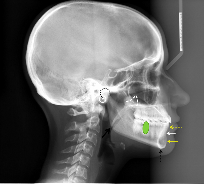 lateral skull anatomy mandible with animations