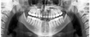 Case of the Week: Cleft Palate