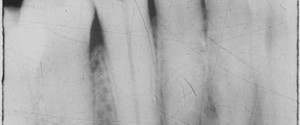 Case of the Week: Ameloblastoma