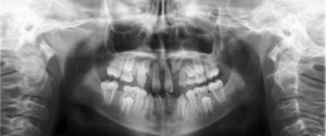 Case of the Week: Ectodermal Dysplasia