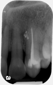 locate the object may 2014 periapical 1