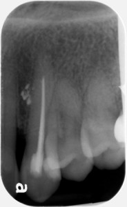 locate the object may 2014 periapical 2