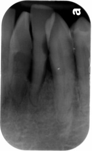 canine periapical radiograph lto June 2014 b