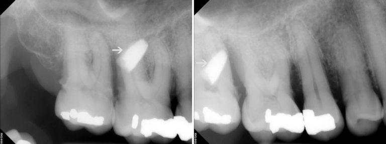 SLOB rule – Dr. G's Toothpix